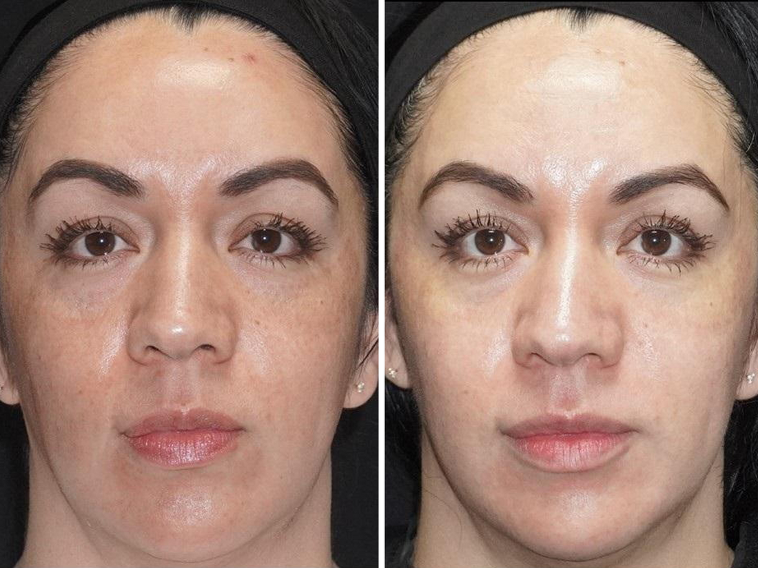 Refresh Dull Complexions for a Natural Glow.