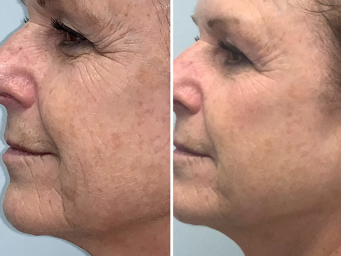 Revive Dry, Lifeless Skin with Intense Plumping.