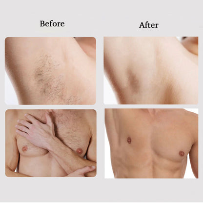 Free Megelin M1 IPL Hair Removal - Megelin